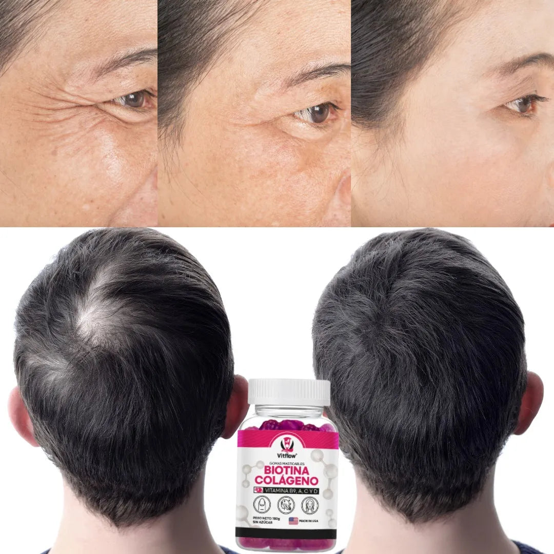 Gomitas Biotina Con Colágeno Vitamina B9, A, C Y D